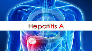 Health officials: 2 die from hepatitis A in Salt Lake County