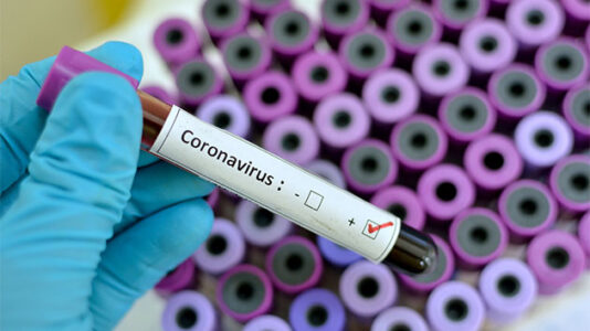 Pentagon to provide housing support to HHS for evacuees over coronavirus concerns