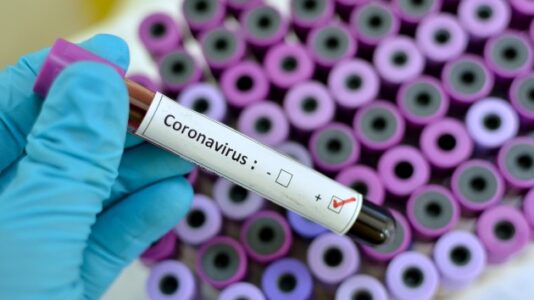 140 dead in US, Italy coronavirus fatalities continue to soar