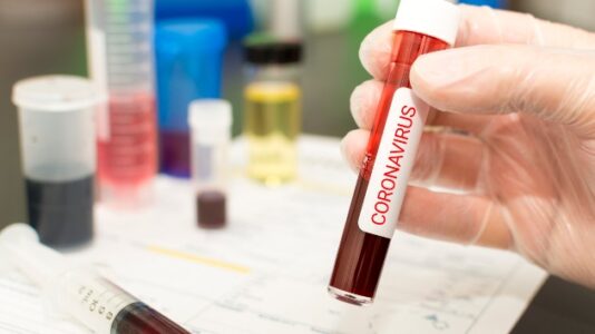 Coronavirus live updates: Over 200,000 now dead from COVID-19
