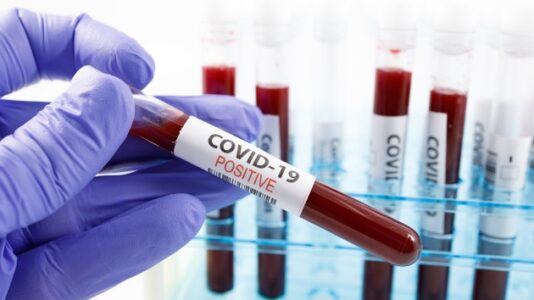 Coronavirus updates: COVID-19 was present in Europe in December, doctor claims