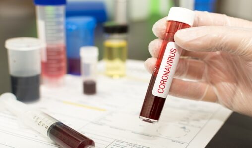 Coronavirus updates: NYC mayor slams White House economic advisor as ‘cheapskate’
