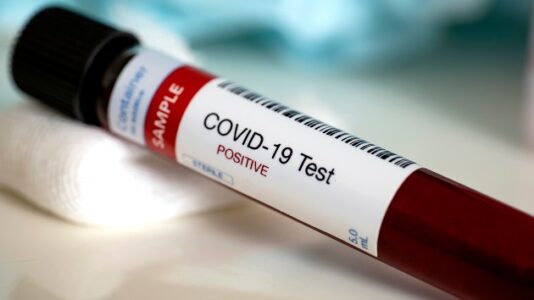 Up to 150K coronavirus deaths possible by July 18, CDC says