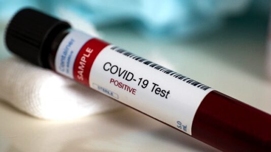 ‘ICUs are full, patients are dying’: 3 Alabama counties see largest jump in weekly cases