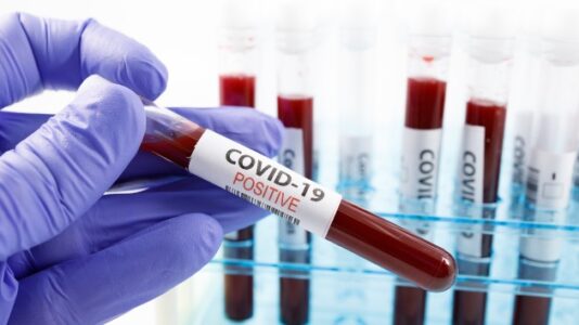 Coronavirus updates: 85 members of shipping vessel in Alaska test positive for COVID-19