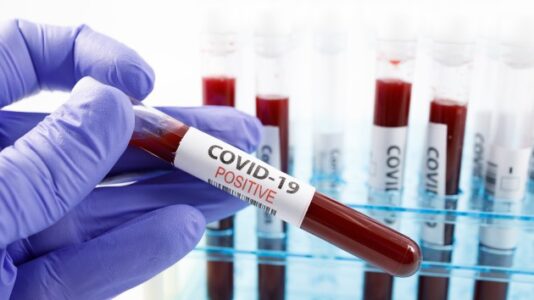 Coronavirus updates: Coronavirus updates: Florida records a record 11,458 new COVID-19 cases
