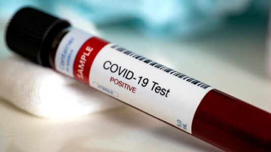 Coronavirus live updates: US virus cases may be about 8 times higher than reported