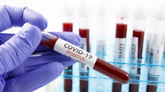 Coronavirus updates: US sets record number of new cases, hospitalizations