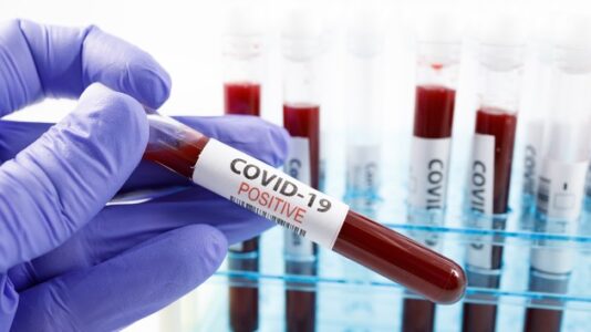 Coronavirus updates: TSA screens record number of travelers since pandemic began