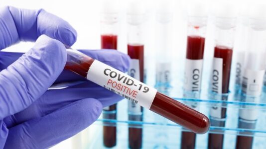 Coronavirus live updates: US sees record death total