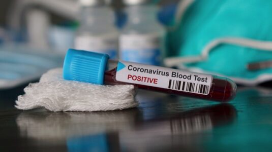 Coronavirus live updates: Trump’s Mar-a-Lago club warned about mask violations
