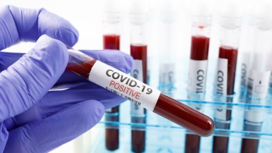 Coronavirus live updates: South Africa variant ‘more of a problem’ than UK strain