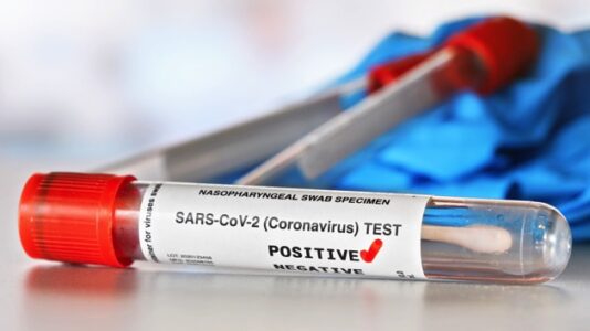 COVID-19 live updates: US deaths jump 317% in 7 weeks