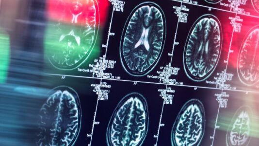 Louisville mass shooting suspect’s brain will be tested for CTE, family spokesperson says