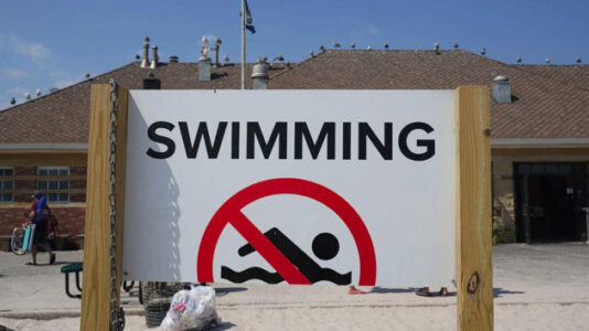 Woman in critical condition after being bitten by shark at Rockaway Beach in Queens