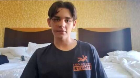 Boy, 13, speaks after avoiding major injury in nearly 100-foot Grand Canyon fall