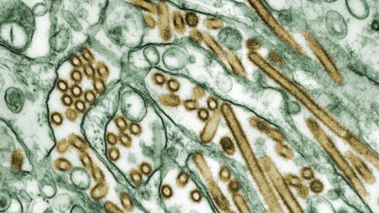 Bird flu cases rise to 31 in US, still no evidence of person-to-person spread: CDC